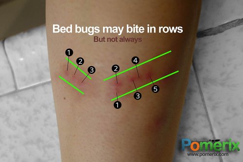 Figure 3: Bed bugs sometimes bite in a row, but not always.