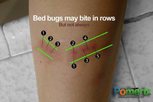 Figure 1: Bed bugs sometimes bite in a row, but not always.